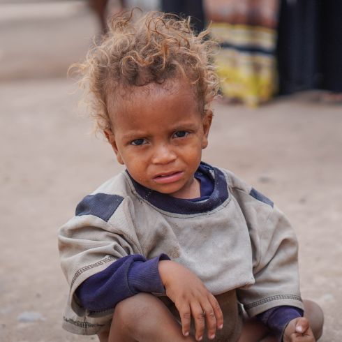Un enfant de 18 mois réfugié dans un camp au Yemen