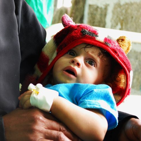 Un enfant malade au Yemen dans les bras de son père
